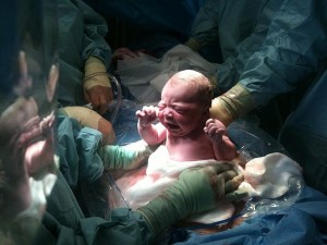 El parto: Cesarea